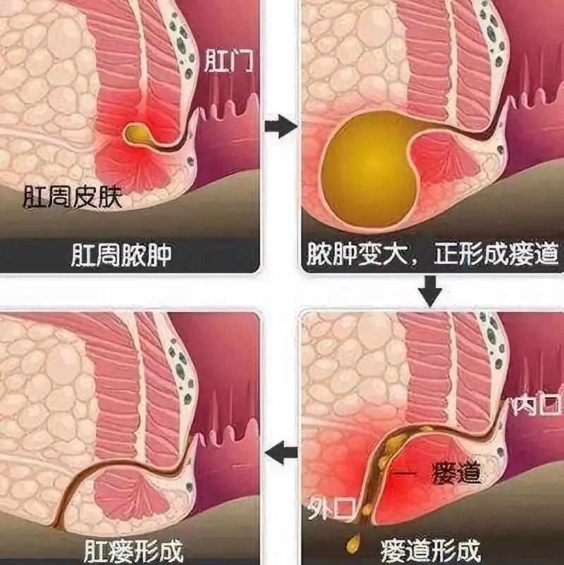 雁过拔毛 第3页